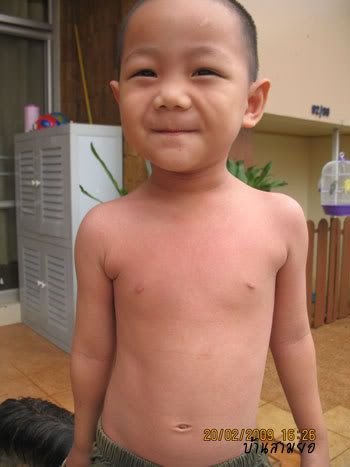 หยุน เป็นไข้อีดำ อีแดง ค้าบ