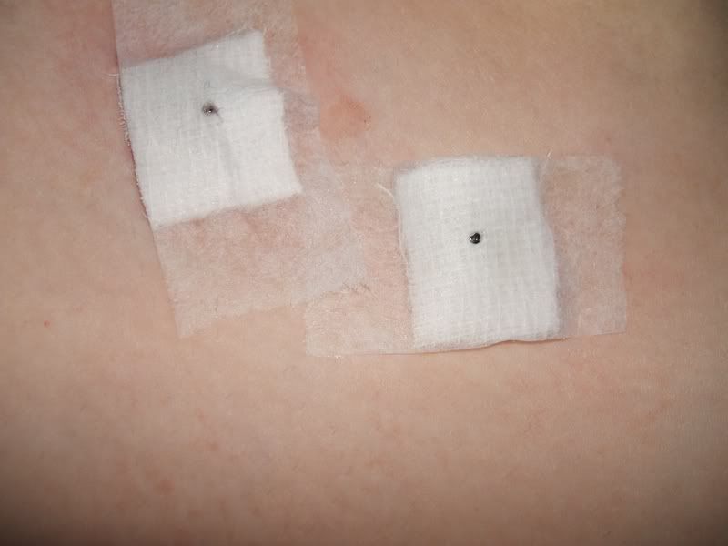 I'll also keep a diary of the healing process for anyone who wants to know 