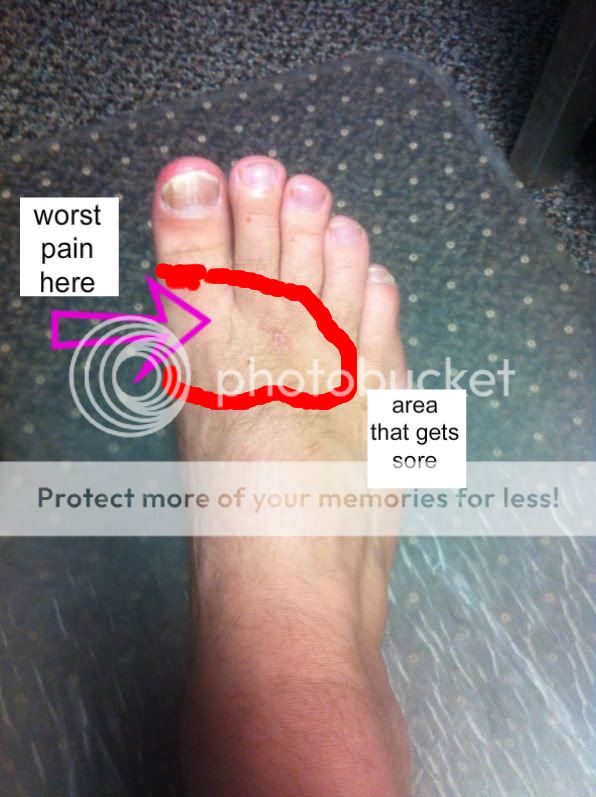 Pain while walking barefoot | Barefoot Runners Society